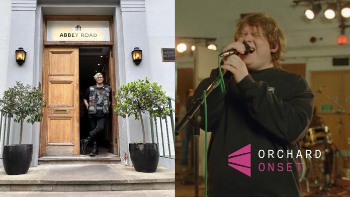 Onset for Lewis Capaldi (Live from Abbey Studios) 🎙️